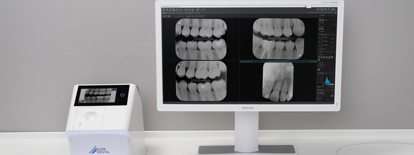 Digitales Röntgen 2